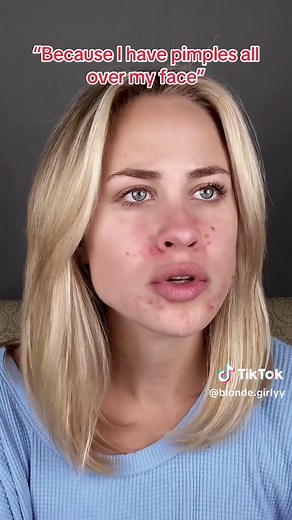 Understanding Body Dysmorphic Disorder: Symmetry, Filters, and Mental Health