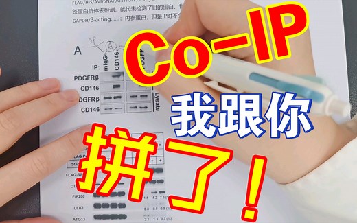 【文献阅读】愿世间没有看不懂Co-IP的眼睛| Co-IP原理 读图