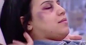 Vidéo - Comment se maquiller pour cacher des bleus ? Le tuto beauté qui fait scandale