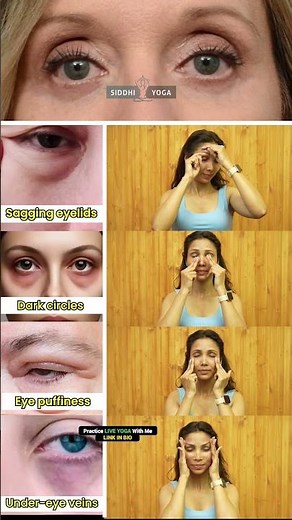 Eye Yoga for Bright & Healthy Eyes | Siddhi Yoga