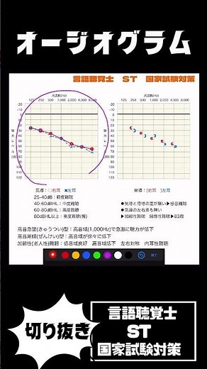 27-94 オージオグラムからどんな疾患か読み解く オージオメーターの読み方 気導骨導 高音急墜型と高音漸傾型の違い 加齢性難聴(老人性難聴)とは 感音難聴の内耳性難聴と後迷路性難聴？