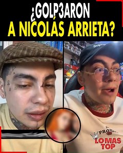 698K views · 4.2K reactions | ¿G0LP3ARON a Nicolás Arrieta? él mismo contó todo lo que pasó. ¿Qué opinas sobre esto? | Lo Más TOP | Facebook