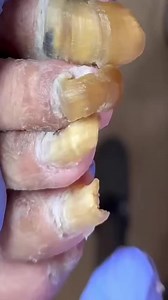 2K views | Watch what comes out of this thick toenail CUCS Beautiful moments of care and relaxation through a gentle pedicure experience. Simple, clean, and satisfying. ✨ Disclaimer: This video is for educational and relaxation purposes only. All content belongs to the respective owners, no copyright infringement is intended. | Toenail 23 | Facebook