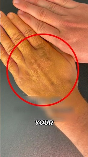 If Your Skin Turns Yellow… Don’t Ignore This Warning