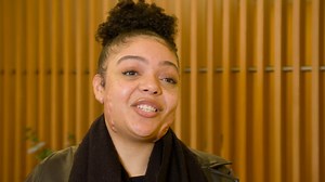 79K views · 1.5K reactions | Bianca has keloid scars across her jawline and seeks the help of Dr Emma Craythorne to get them removed. #TheBadSkinClinic Watch full episodes on discovery+: https://bit.ly/3HfHr6e | Love Science | Facebook