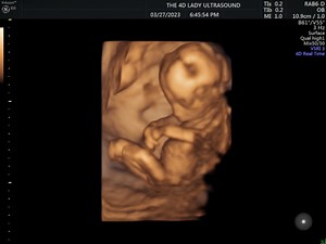 Baby keeps putting those little hands together and it just melts my heart! #14weeks | The 4D Ultrasound Lady