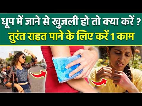 Dhup Me Jane Se Khujli Ho To Kya Kare: धूप में जाने से खुजली हो तो करें ये 1 काम | Boldsky
