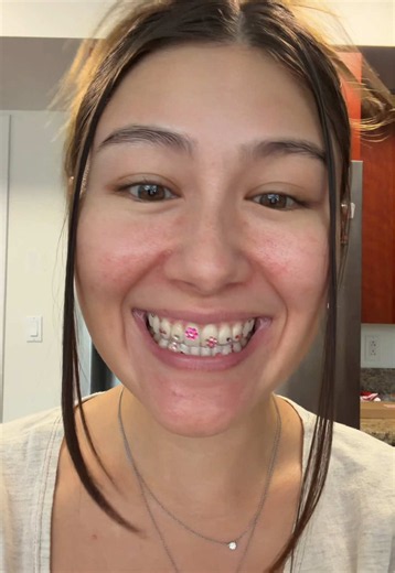 the tooth gems were a hit!! And shoutout to my awesome ortho dr. won chaekel!
