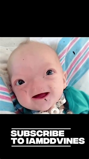 People without body parts 😳#babygirl