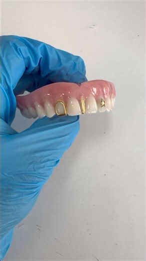 Full upper denture w gold ! Do you like gold on your denture? #dentaltechnician #dentist
