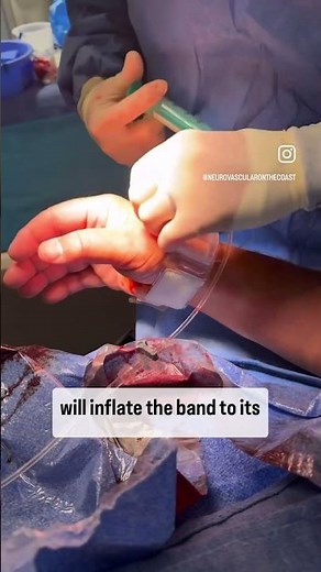 Snuff Box Closure by the Best! Our team shows you TR band closure for Snuff Box Radial Access