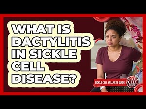 What Is Dactylitis in Sickle Cell Disease?