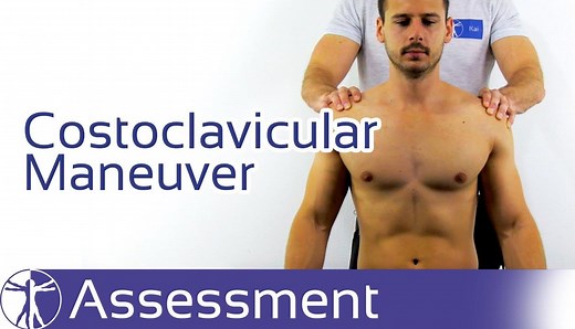 Costoclavicular Maneuver for TOS holding each position for up to 30 s, while the patient rests his or her forearms on his thighs. The examiner simultaneously monitors a change in pulse and symptom onset and notes which positions exacerbate or ease symptoms. studies have been conducted reporting sensitivity or specificity values, which is why its clinical value remains questionable. The value of this battery of test positions is then also rather evaluate which positions provoke and relieve sympto