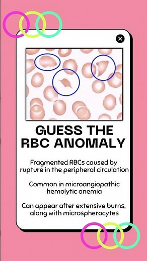 Guess the RBC ANOMALY #6 | Hematology Review
