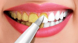3.4M views · 75K reactions | 30 Astuces Incroyables Pour Des Dents Bien Blanches || Astuces Et Conseils Beauté: | Sympa | Facebook
