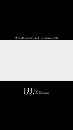 2.3K views | Face lift before&after results -WJ ✨️ Over 20 years of...