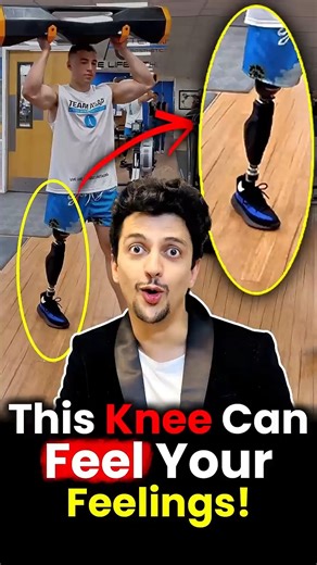 MIT_s Bionic Leg - The Latest in Prosthetic Technology | GREAT IDEAS GREAT LIFE