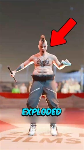 These People Were Horribly Injured Live on Stage — and the Crowd Had No Idea 😱