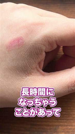低温やけど