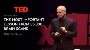 What Brain Scans Tell us - HappyNeuron Pro - Blog