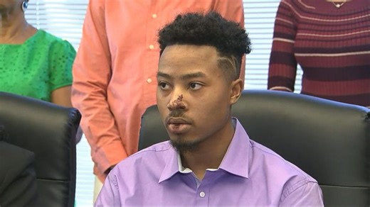 Police beating man during traffic stop caught on video