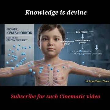 Malnutrition & Vitamin Deficiency | Imp Q& A | Kwashiorkor, Marasmus & Vitamin B12 #education