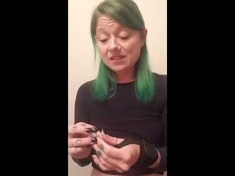 Stelara Self-Injection #3 - Side Effects Discussion