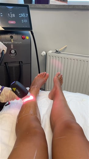 Advanced Laser Hair Removal Techniques in Berlin