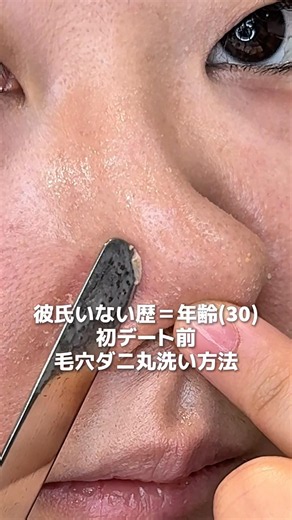 毛穴拡大したらボツボツすぎてやばかった😭垢抜けは肌質改善から！ってネットで見て頑張って見ました😊#毛穴 #クレンジング #垢抜け#チャプトナイン #pr