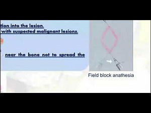 Biopsy: Types and Indications