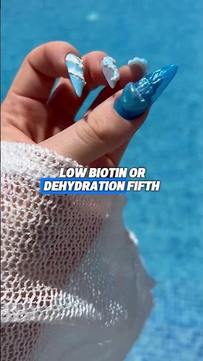 9 Things Your Nails Can Tell You About Your Health | Hidden Health Warning Signs