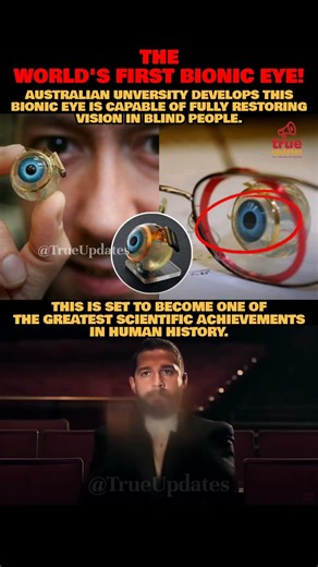 The World's First Bionic Eye!👏🏻 #bioniceye #australia #eyes #inventions #helath #blind