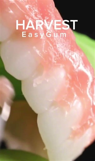 Carving Gingival Contours with Harvest EasyGum® (So Satisfying)