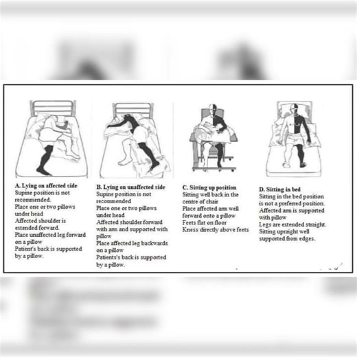 #physioexercises