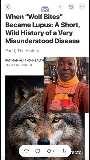 Did you know lupus literally means wolf? Over a thousand years ago, doctors thought lupus looked like wolf bites on the face. No tests. No answers. Just fear. And somehow… that name stuck. This is where the story really begins. My 3 part series explores the history, myths, and realities of lupus. Go to my Substack for Part I. Link in bio.#lupuswarrior🦋💜 #lupus #lupuslife #creatorsearchinsights