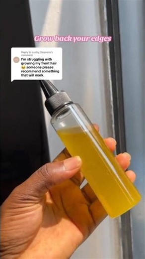 How to Regrow Your Edges Naturally with This Powerful Hair Growth Oil #shorts