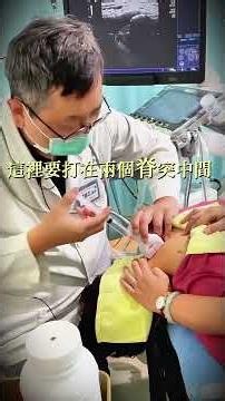 非開刀矯正 精準注射撬動整個頸椎力矩效應｜堅持脊建-來得脊