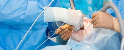 Sinus Lift for Dental Implants: Cost, Risks, and Recovery - Dentaly.org