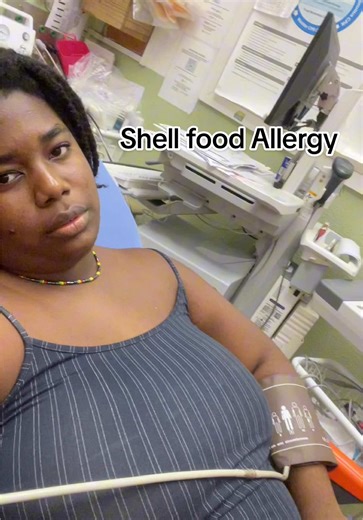 Shellfish Allergy Reaction: A Personal Story