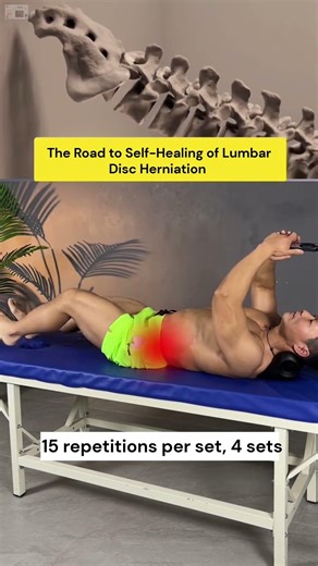 The Road to Self-Healing of Lumbar Disc Herniation | 15 Reps × 4 Sets Recovery Method