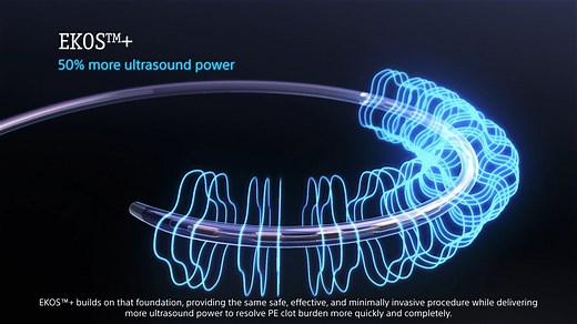 EKOS+ Endovascular System: How it works