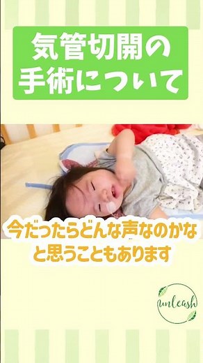 気管切開の手術について