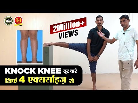 What is Knock Knee? How to solve Knock Knee problem for Medical in Army, Air Force and Navy?