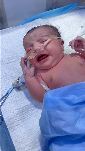 Emotional Moment: Newborn Baby’s First Cry After Birth | Miracle of Life #prematurityday #