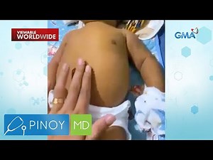 Viral video ng sanggol na malaki ang tiyan at nanghihina, ano nga ba ang karamdaman? | Pinoy MD