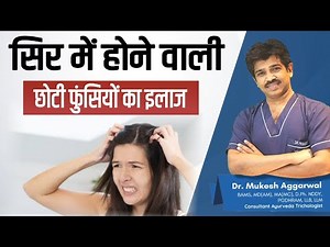 Causes & Treatment of Scalp Pimples | Why Scalp Acne Occurs ? | Dr Mukesh Aggarwal