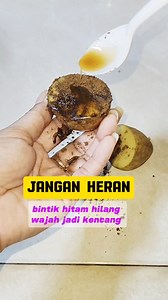 779K views · 5.9K reactions | Wajah kencang bintik hitam hilang.rutin pakai ini #idekreatif #tipcantik #tutorial #lifehack | Ahzalea Syahida | Facebook
