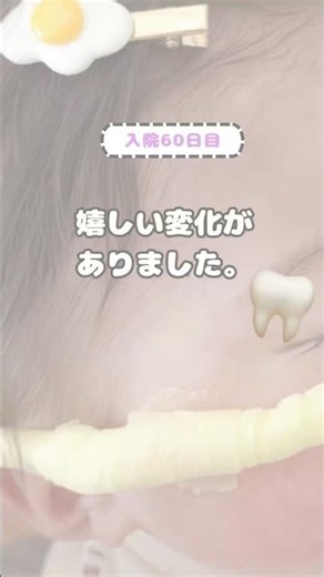 10ヶ月目でついに……🦷✨ #難治性てんかん