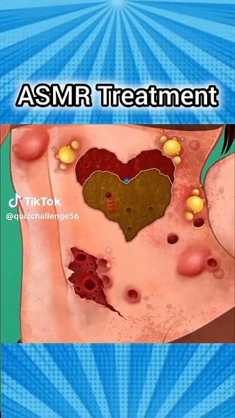 Effective ASMR Treatment for Eye Mucus Relief