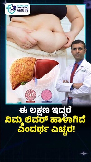 This ONE Waist Measurement Reveals Your Fatty Liver Risk (Doctors Explain)